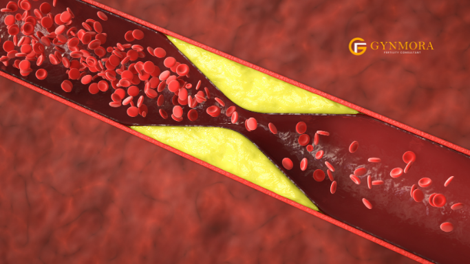 List of Blood Tests for Recurrent Miscarriage